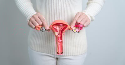 blog_What Is Endometriosis and How Is It Treated_ A Guide to Understanding the Condition (3)